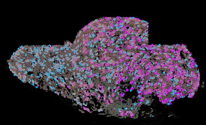 Cause of sleep disturbance in cardiac disease identified: Ganglia play previously unrecognized role