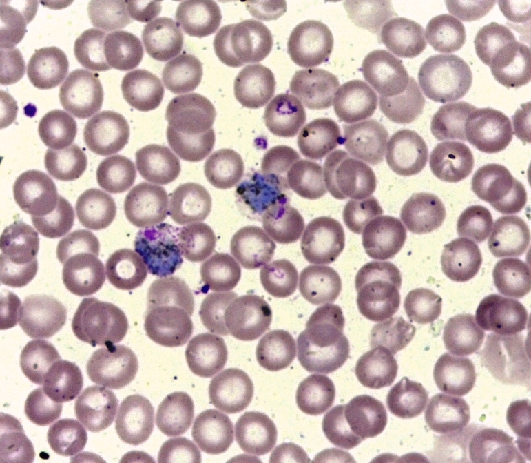 DAILY DOSE: Malaria threatens the United States; India makes strides in outer space and underground.