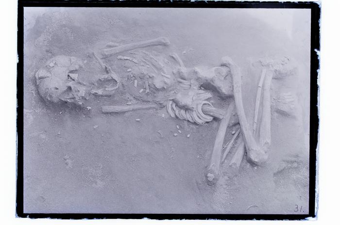 Japan’s ancient practice of cranial modification: The case of the Hirota people in Tanegashima.