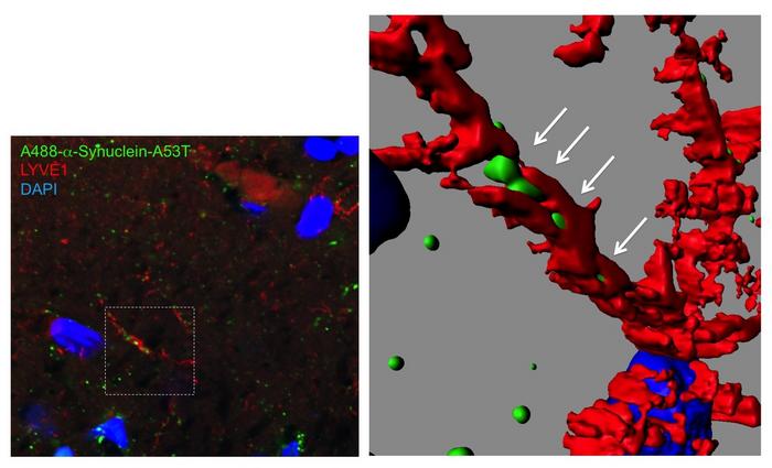 A secret passage for mutant protein to invade the brain.