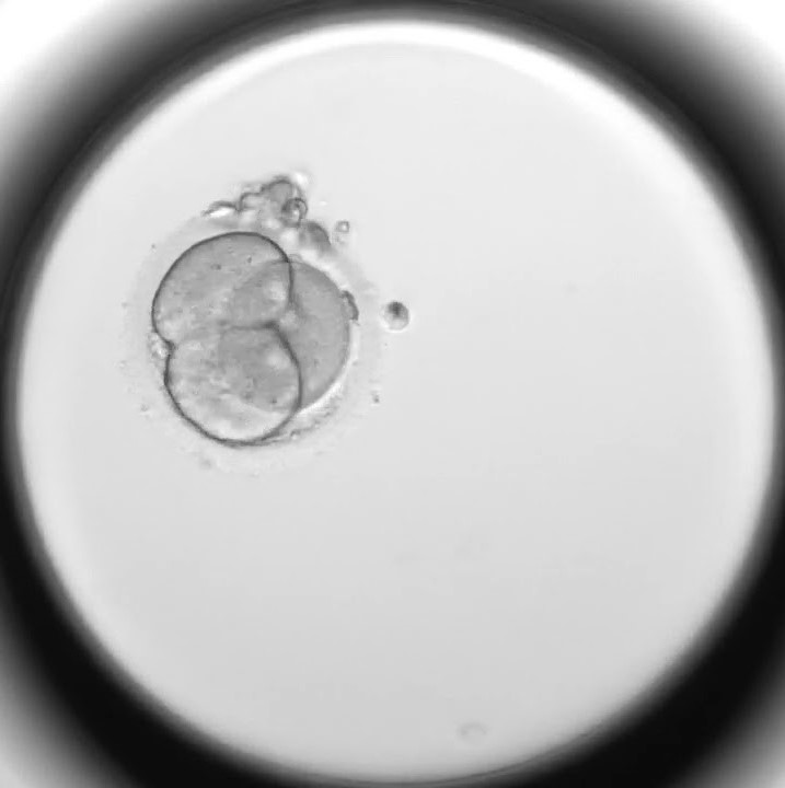 Researchers studied thousands of fertility attempts hoping to improve IVF