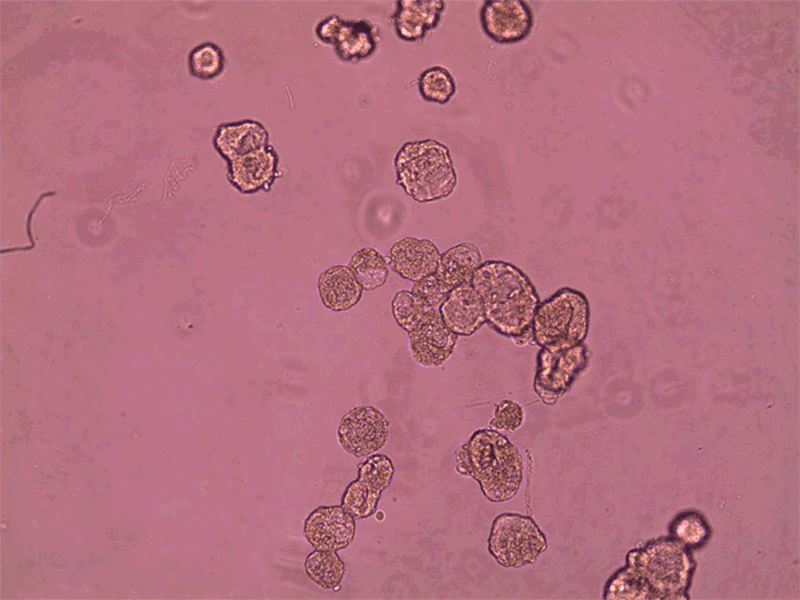 DAILY DOSE: World leaders talk climate change; March of the microscopic robots.