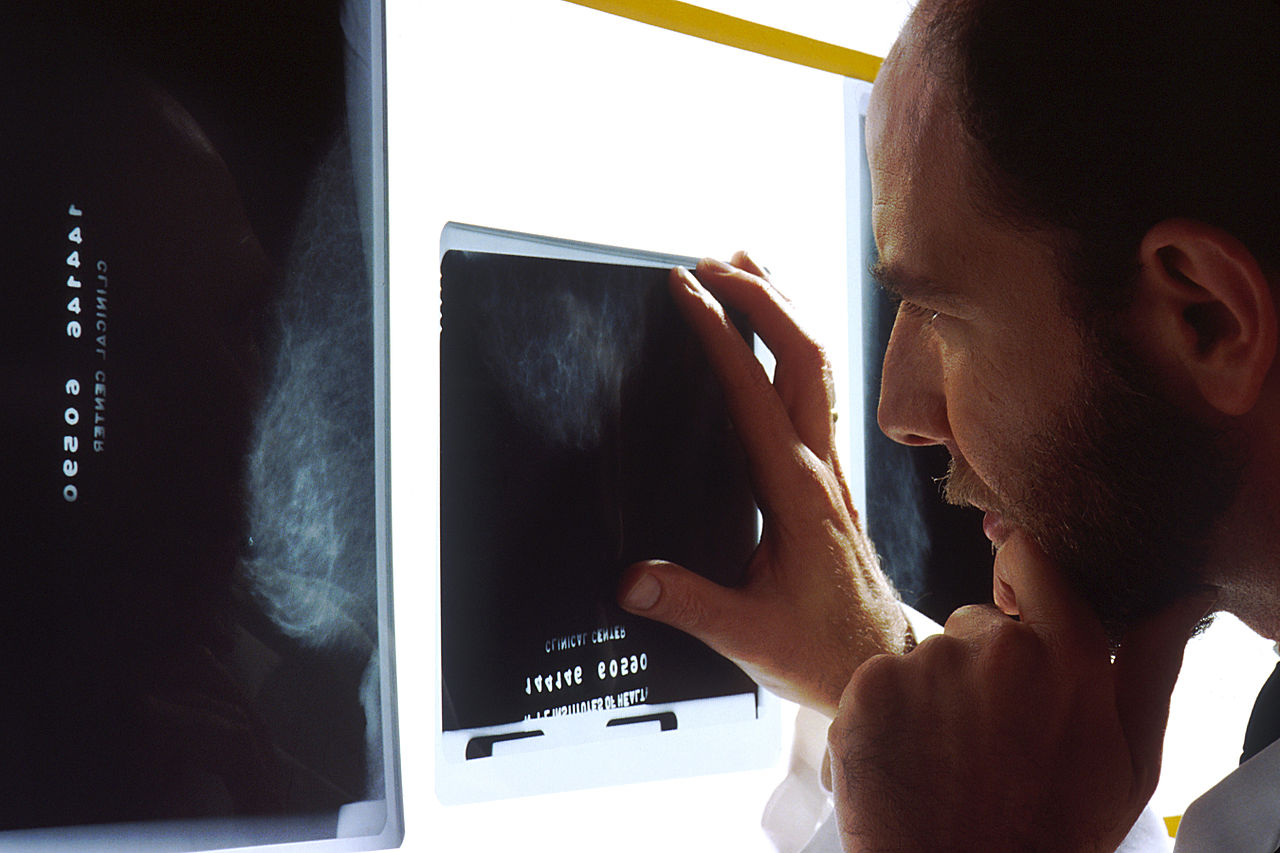 More than 900 chemicals, many found in consumer products and the environment, display breast-cancer causing traits.