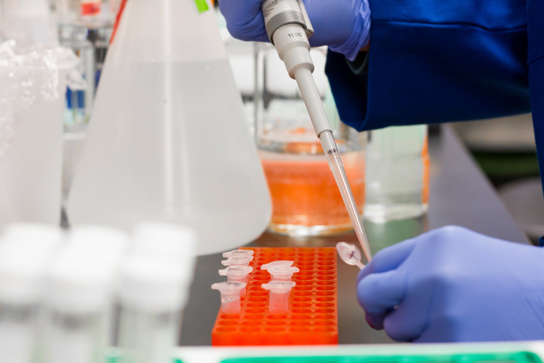 Resource shortages and technological lag remain obstacles for acute myeloid leukemia treatment in Latin America