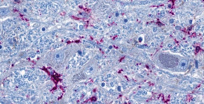 How COVID-19 affects the brain