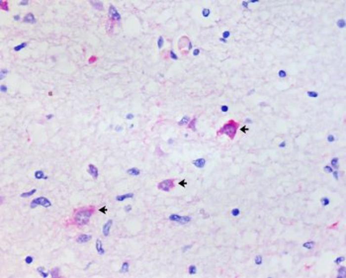 Rare case of opossum infected by rabies sounds alarm regarding circulation of this virus in urban environments