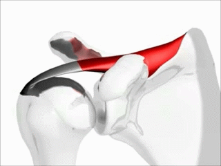 Mimicking natural connections could improve rotator cuff repair