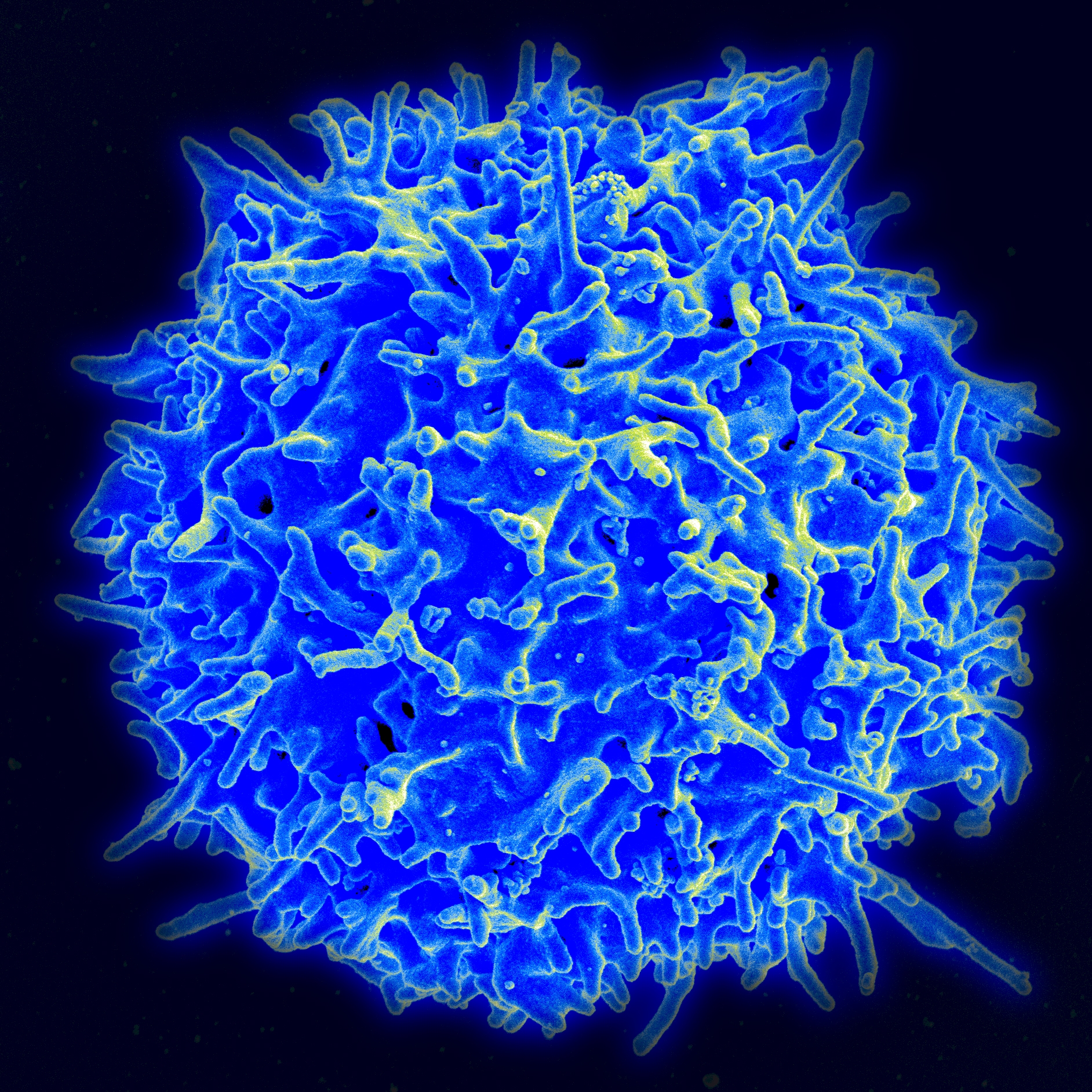 Scientists decode gene circuits of human immunity, fueling new era of disease research