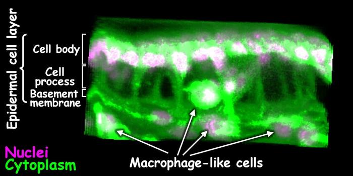 Transient structure in fly leg holds clue to insect shape formation