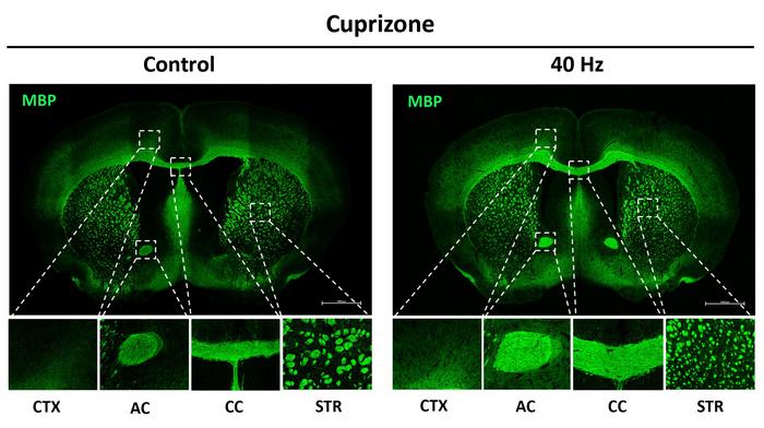 Study reveals ways in which 40Hz sensory stimulation may preserve brain’s ‘white matter’