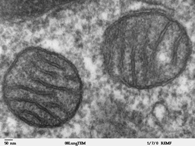 A mitochondrial protein may hold the secret to longevity, new study finds