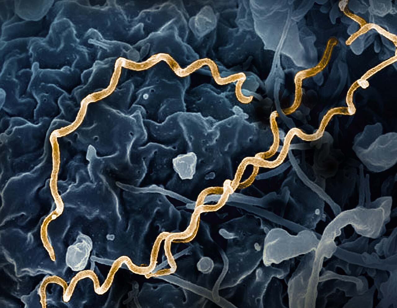 Searching for a vaccine against an ancient scourge