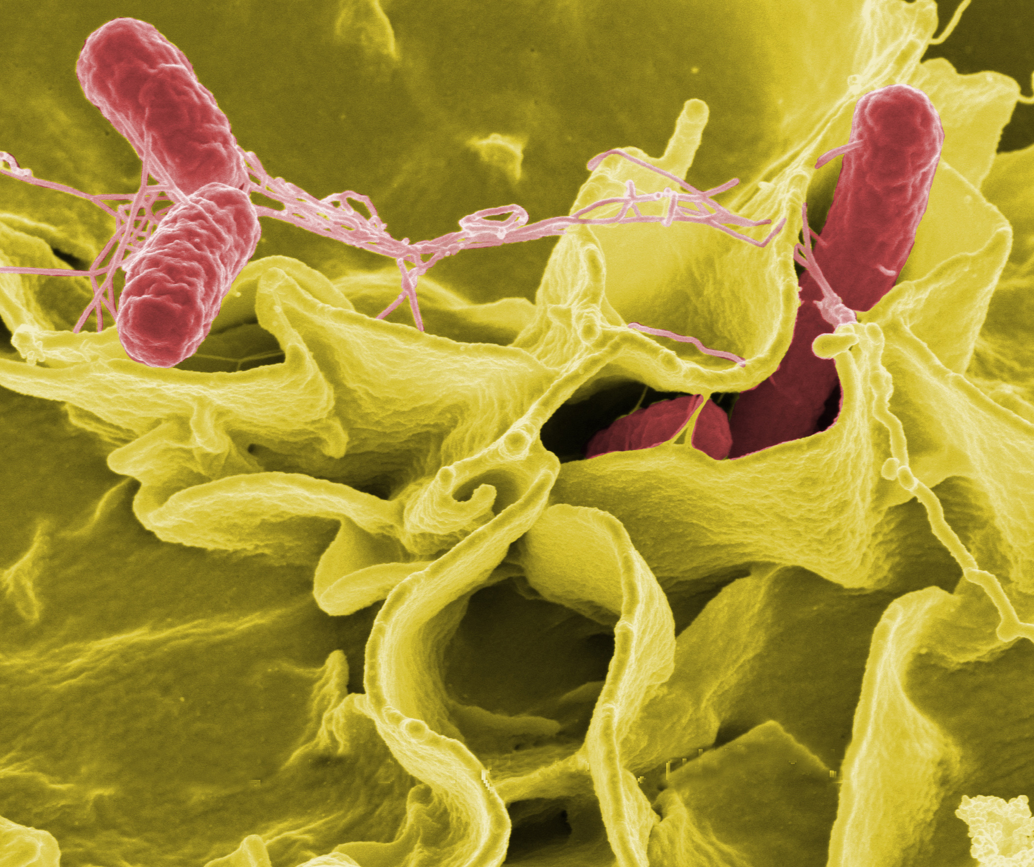 New study shows how salmonella tricks gut defenses to cause infection