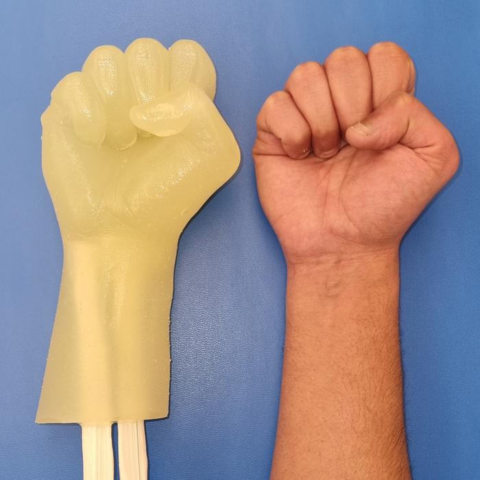 Prosthetic material could help reduce infections from intravenous catheters