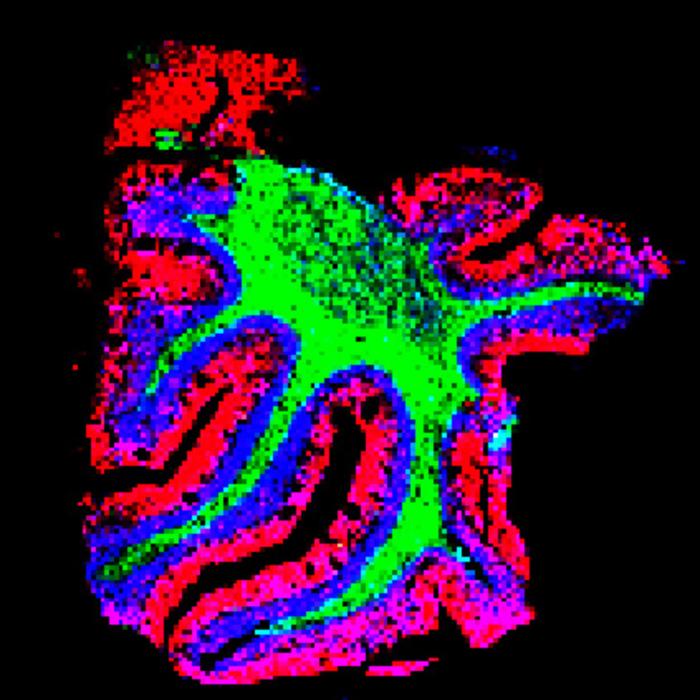 New technique expands tissues so hundreds of biomolecules can be seen inside cells