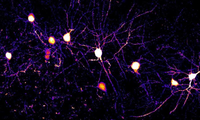 Groundbreaking study uncovers how our brain learns