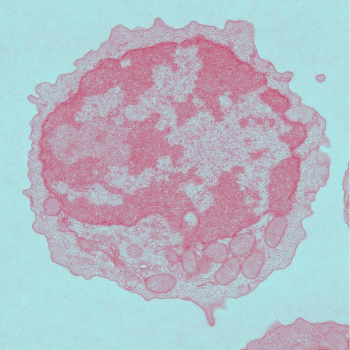 Aging reduces CAR-T cell effectiveness by impairing metabolism, study shows