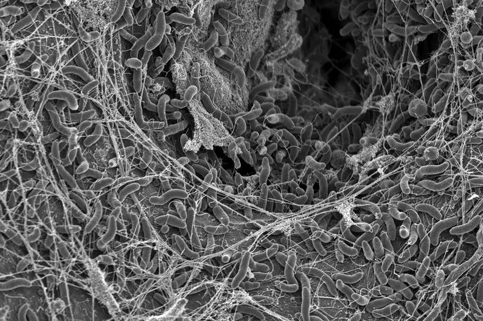 How cholera bacteria outsmart viruses