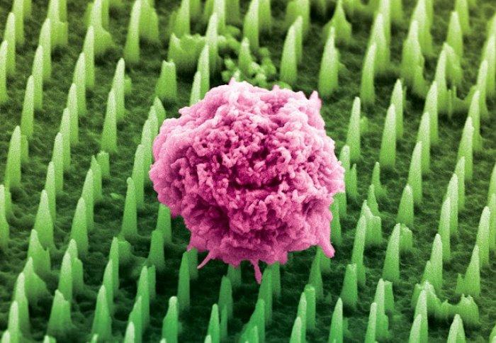 Tens of millions of nanoneedles could replace painful cancer biopsies