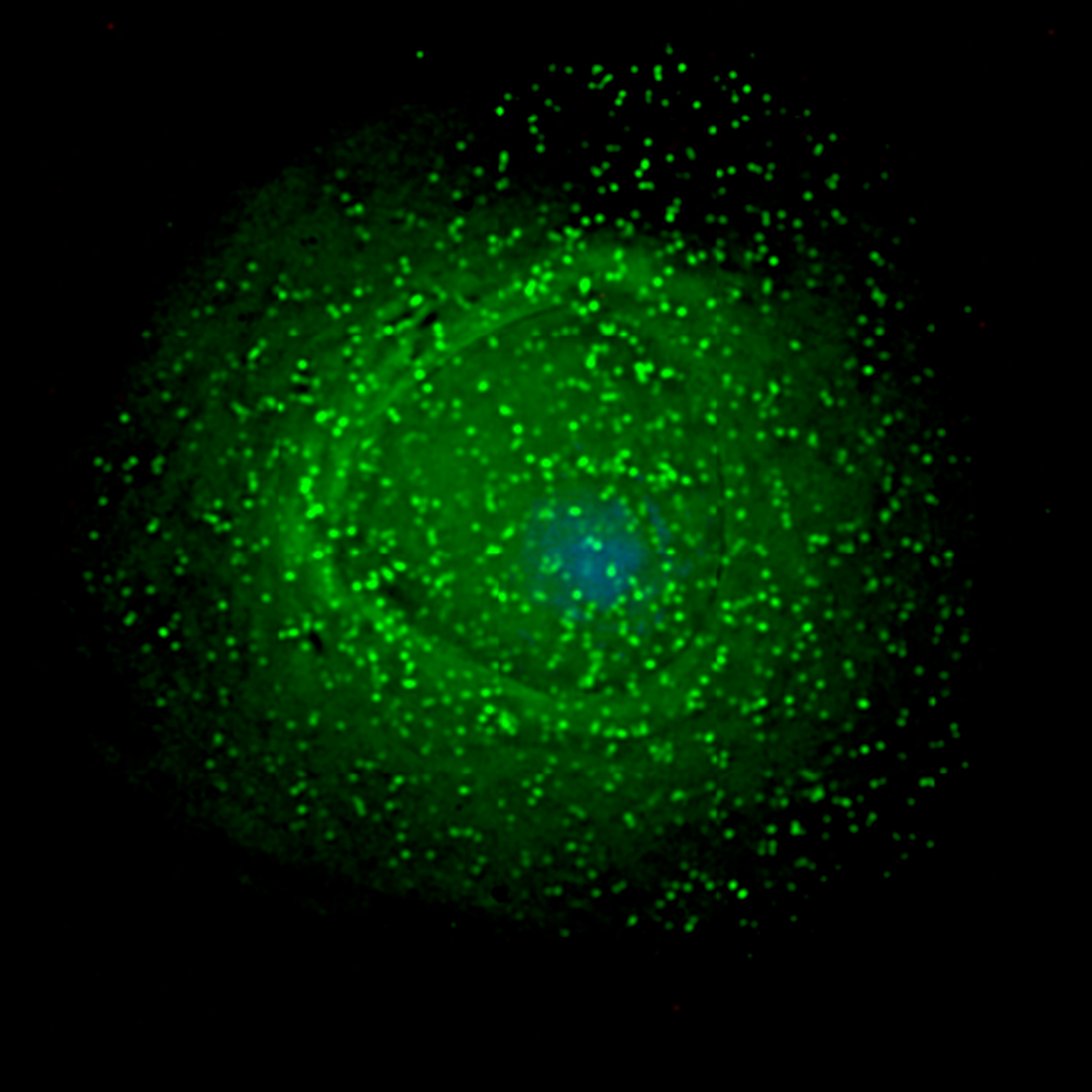 Cancer Medication Helps Reduce SIV Reservoir, Increases Hope for HIV Cure