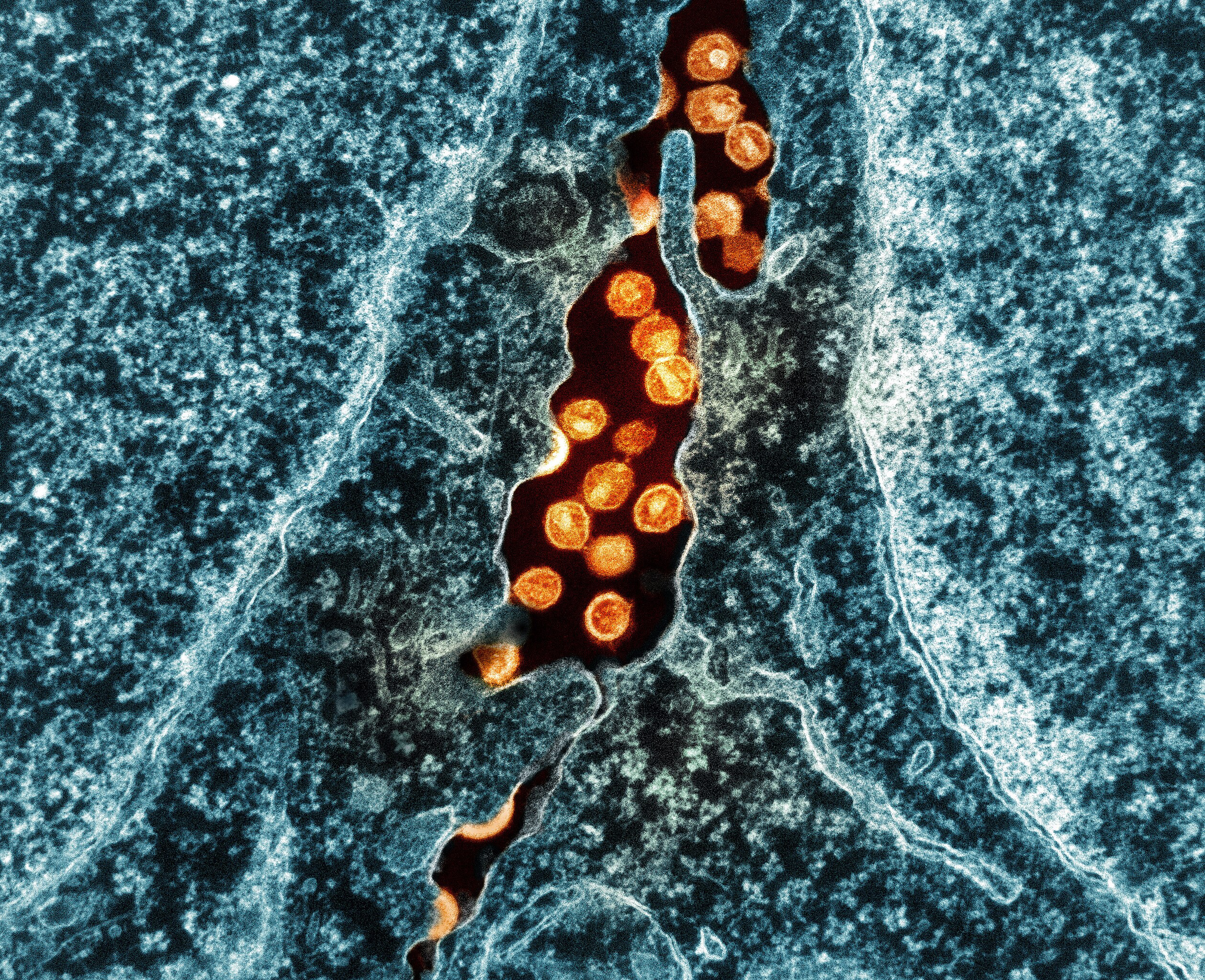 Breakthrough in HIV Vaccine Development: mRNA Technology Shows Promise in Eliciting Neutralizing Antibodies