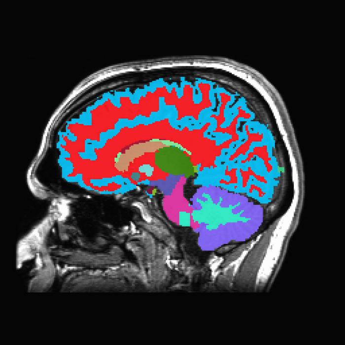 Scientists can tell how fast you’re aging from a single brain scan
