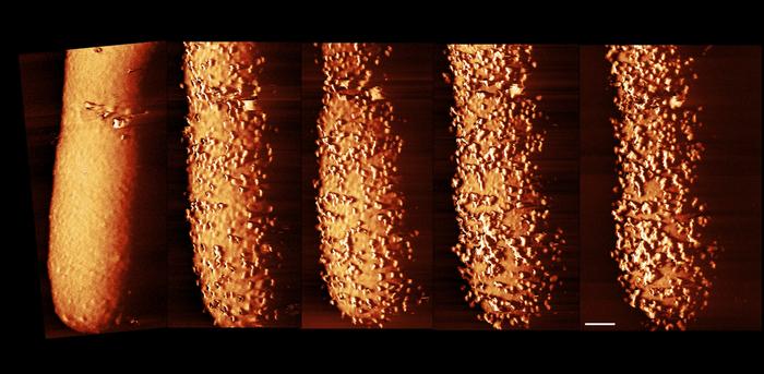 Startling images show how antibiotic pierces bacteria’s armor