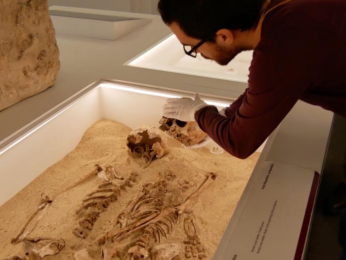 Ancient DNA reveals 12,000-year-old case of rare genetic disease