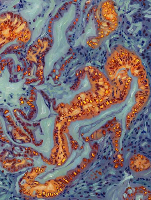 Scientists uncover molecular ‘switch’ that could make pancreatic cancer more treatable