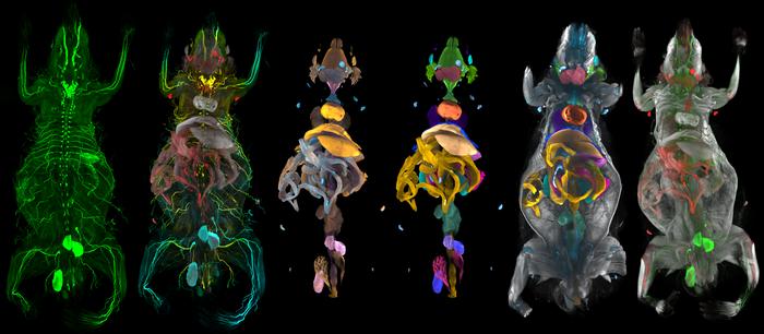 AI atlas reveals hidden whole-body-damage caused by obesity