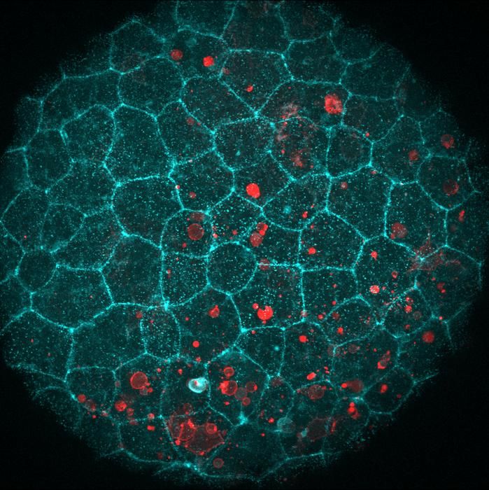 Tissue ‘glue’ also helps swallow dead cells